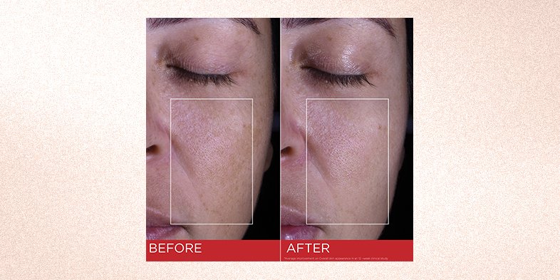 In-Article-common-signs-of-dull-skin_1